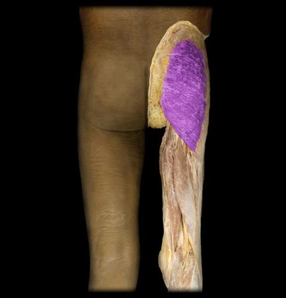 <p>IDENTIFY THIS MUSCLE</p>