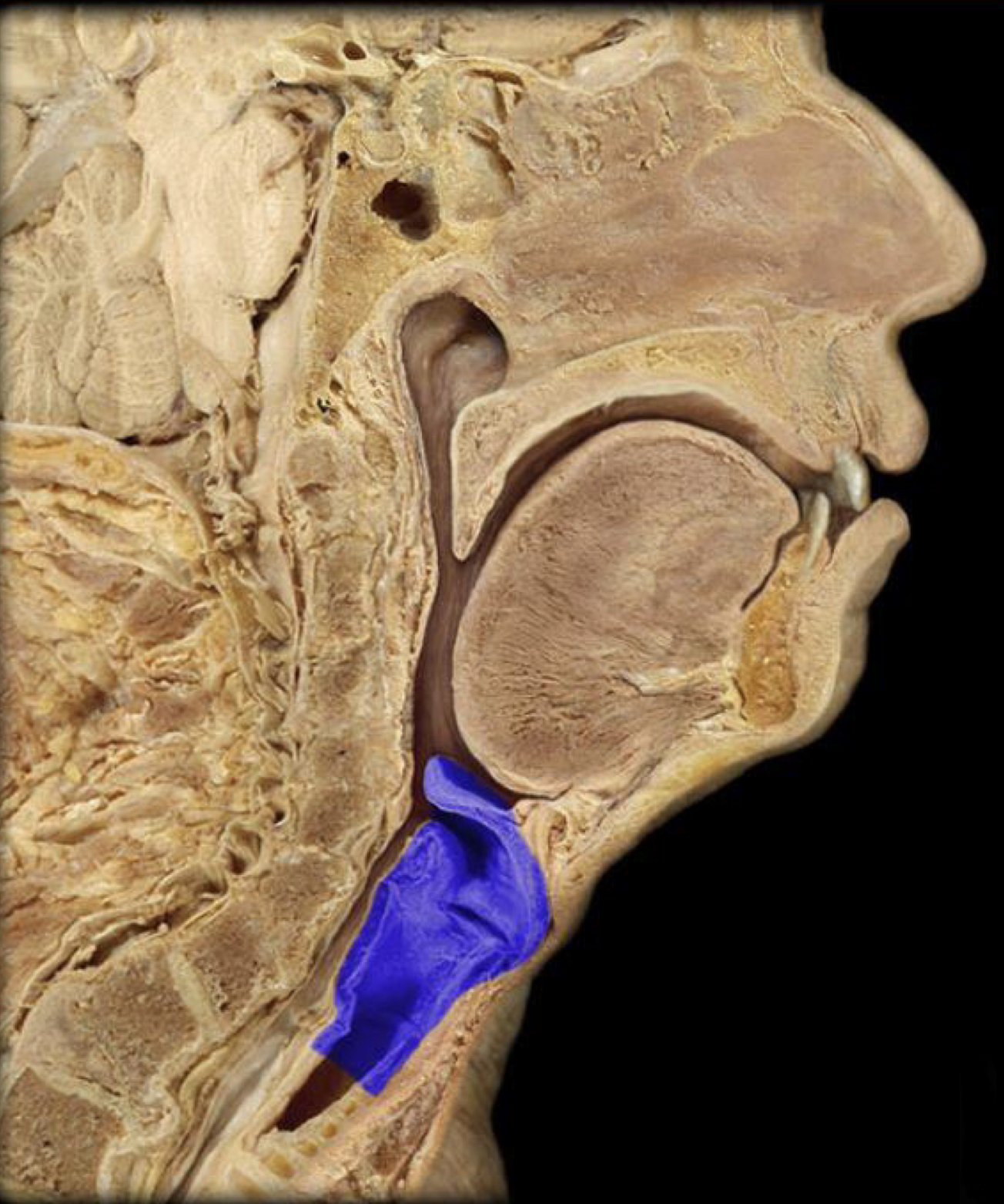 What structure is highlighted in blue?