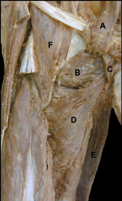 <p>C</p>