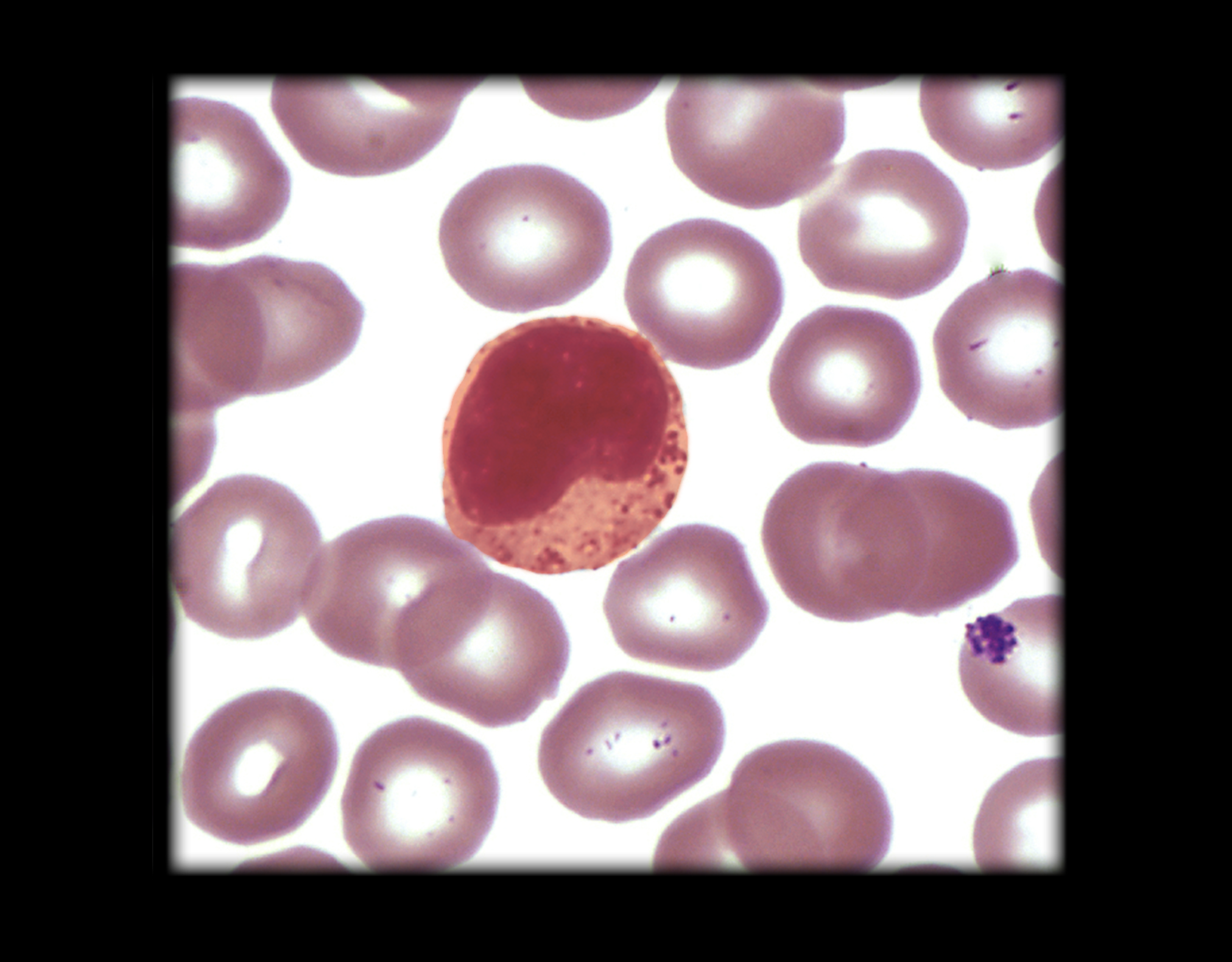 <p>look at giant red orange dot for monocytes</p>