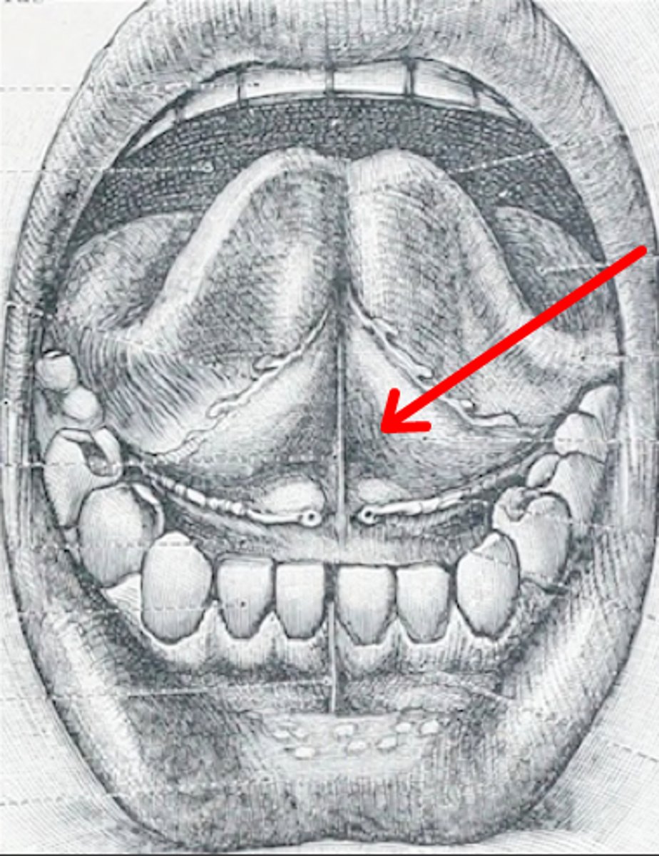 <p>Identify this structure.</p>