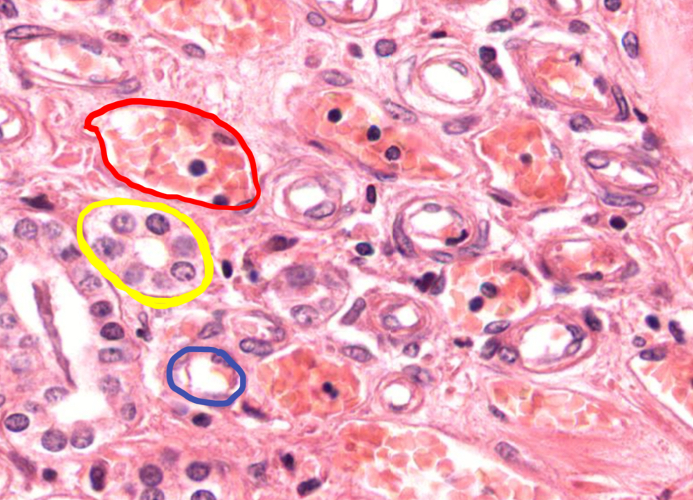 <p>What’s in red?</p>