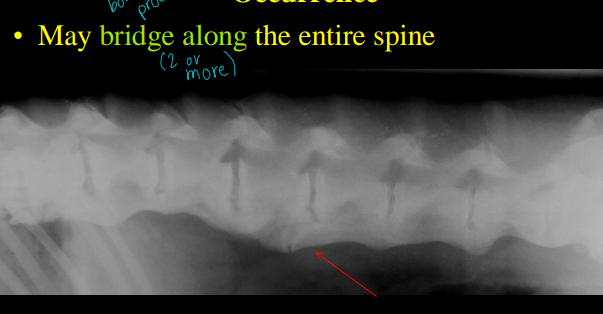 <ul><li><p><strong>Cause</strong></p><ul><li><p><strong><u>Joint instability, idiopathic</u></strong></p></li><li><p>Degenerative</p><ul><li><p>Animals <strong>over 1yr</strong></p></li></ul></li><li><p><strong>Bone exostosis projecting </strong>from the </p><p><strong>vertebral endplates</strong></p></li></ul></li><li><p><strong>CS:</strong></p><ul><li><p>No CS,<u> </u><strong><u>incidental</u></strong></p></li></ul></li><li><p><strong>Views</strong></p><ul><li><p>Lateral and VD</p></li></ul></li><li><p><strong>RS</strong></p><ul><li><p>Smoothly marginated, <strong><u>bony bridging</u></strong></p></li></ul></li></ul><p></p>
