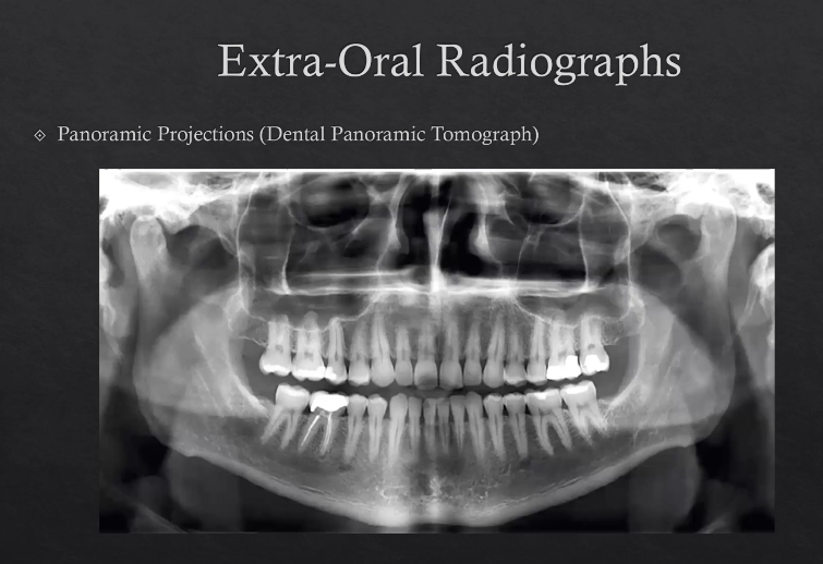 <p>technique is a little more specialized </p><p></p>