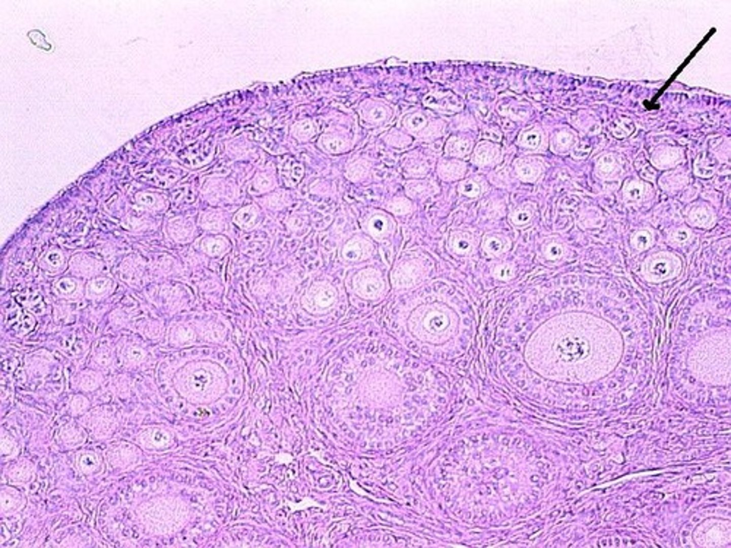 <p>Connective tissue layer</p>