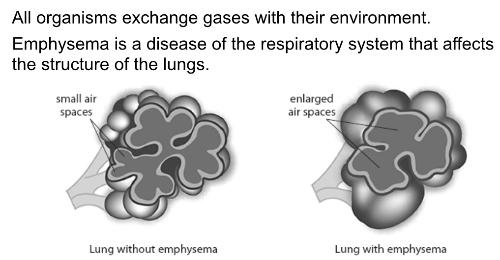 <p>Explain why people with emphysema are given air with a higher concentration of oxygen that atmosphere air</p>