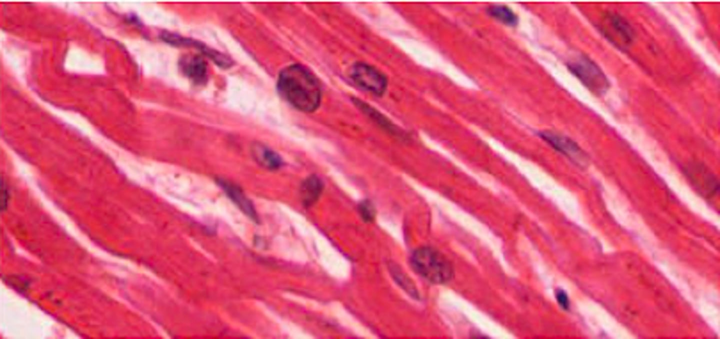 <p>Identify this tissue.</p>