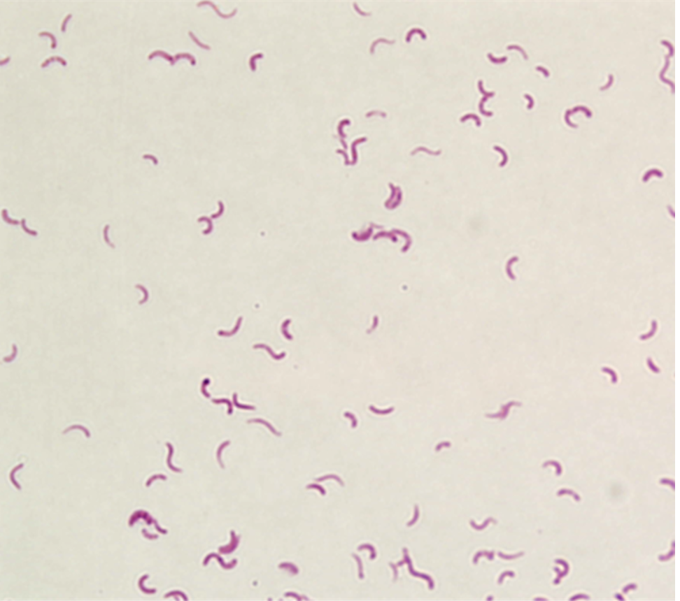 Rhodospirillum rubrum (simple stain)