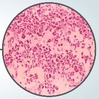 <p>The following gram reaction is pink/red in color. What is it?</p>