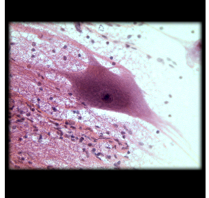 <p>Nervous System</p><p>Communicate between cells</p>