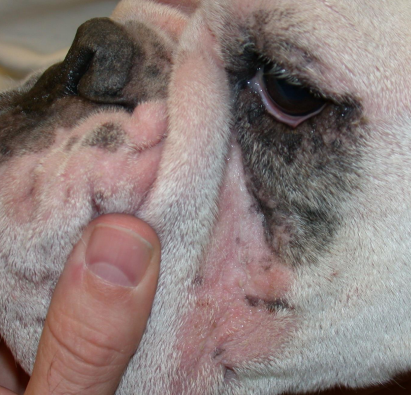 <p><span>Intertrigo</span></p>