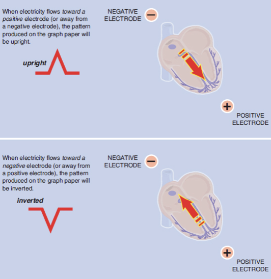 <ul><li><p>Electricity flows <strong>TOWARDS</strong> a positive electrode →<span style="color: green;"><strong> positive (upright) deflection</strong></span></p></li><li><p>Flows <strong>AWAY</strong> from positive electrode → <span style="color: red;"><strong>negative deflection</strong></span> </p></li><li><p>Perpendicular flow → <strong>biphasic</strong> (equally up/down) waveform </p></li></ul><p></p>