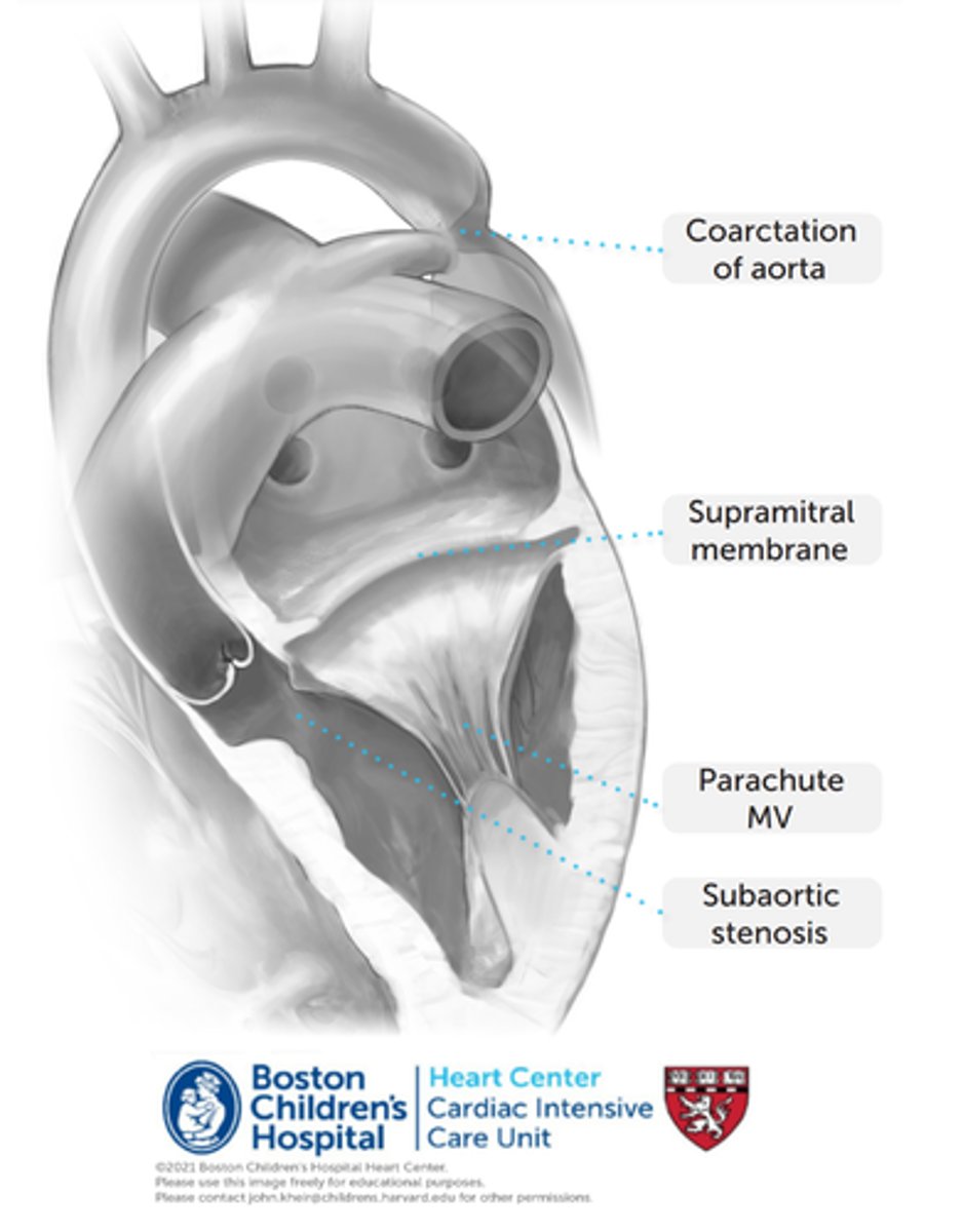 <p>Rare congenital heart disease involving 4 left sided heart lesions. The Supravalvular mitral valve membrane is the first to occur and the other deformities that are more downstream occur after that. </p><p>1) Supramitral membrane in the left atrium. In the most extreme cases, this may be a stenosing, perforated diaphragm above the mitral valve at the mitral annulus. More commonly, this represents a non-obstructive ridge.</p><p>2) Parachute deformity of MV. Papillary muscles converge on a single papillary head (or narrowly spaced papillaries), which limits MV opening.</p><p>3) Subaortic stenosis. Usually associated with subaortic flow acceleration due to marked focal hypertrophy (bulging) of the basal anterior ventricular septum, resulting in a fibrous ridge on top of the muscular bulge.</p><p>4) Coarctation of aorta</p>