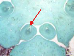 <p>What is being indicated on the Zamia Megastrobilus?</p>