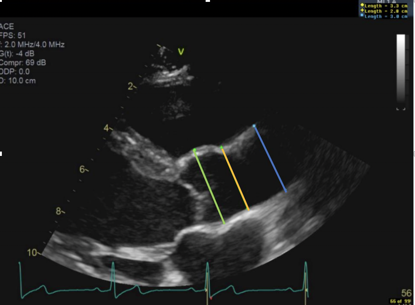 <p>What does the yellow line represent and what is the normal vale</p>