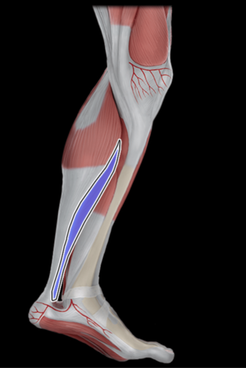 <p>What Muscle Is Highlighted?</p>