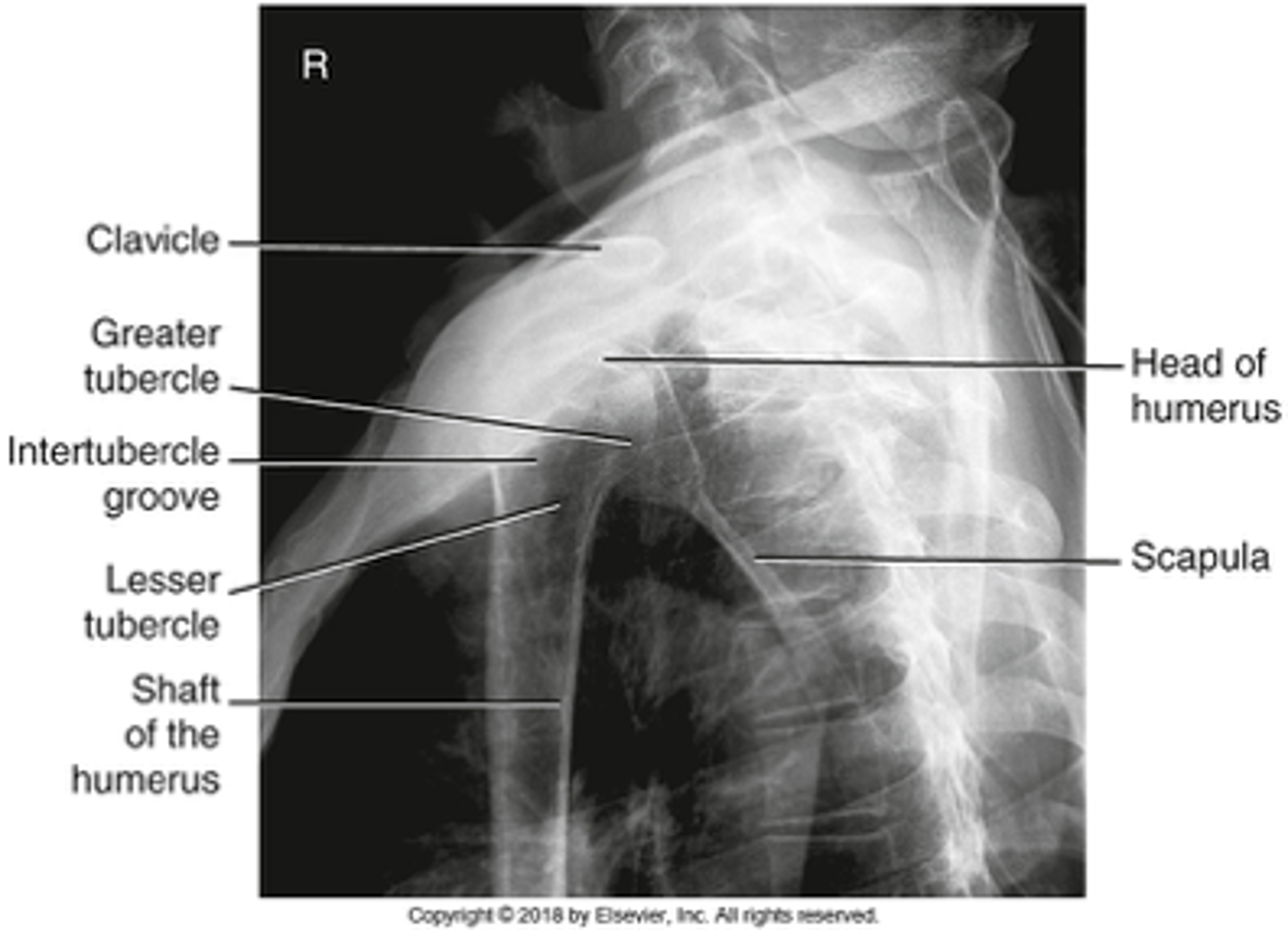<p>- CR perpendicular to surgical neck</p><p>- Breathing technique</p><p>- Proximal humerus clearly seen</p><p>- Humeral head and glenoid cavity seen</p><p>- Humeral head in neutral rotation</p><p>- Optimal exposure factors</p>