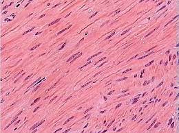 <p>Smooth Tissue</p>