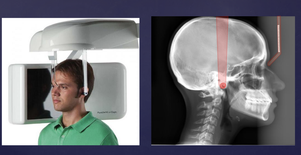 <p>what type of extraoral image is this?</p>