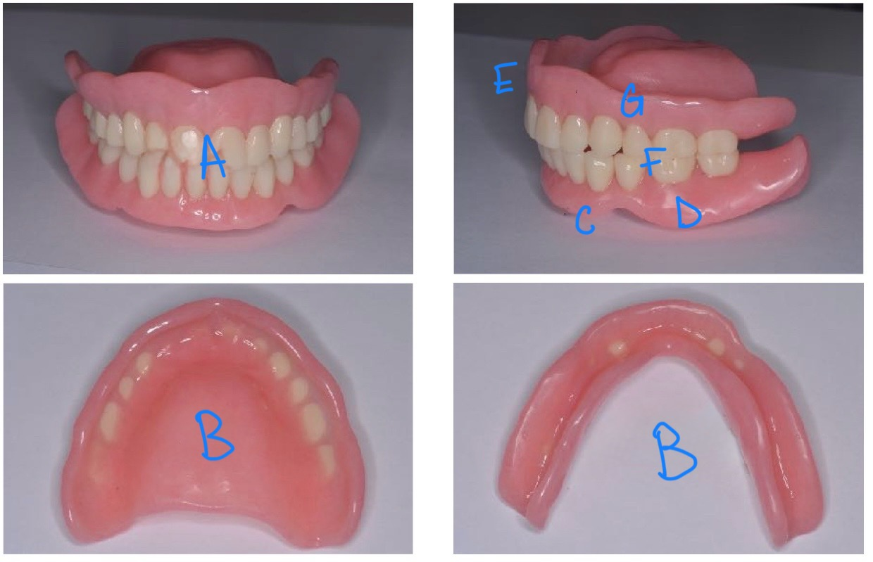 <p>what structure is labeled F?</p>