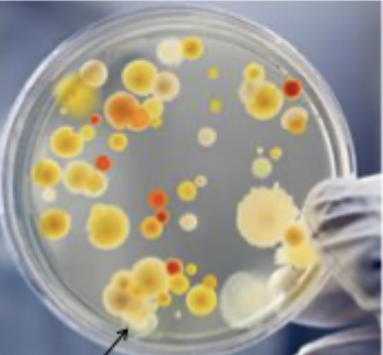 <p>Does this show mixed or pure bacterial growth?</p>