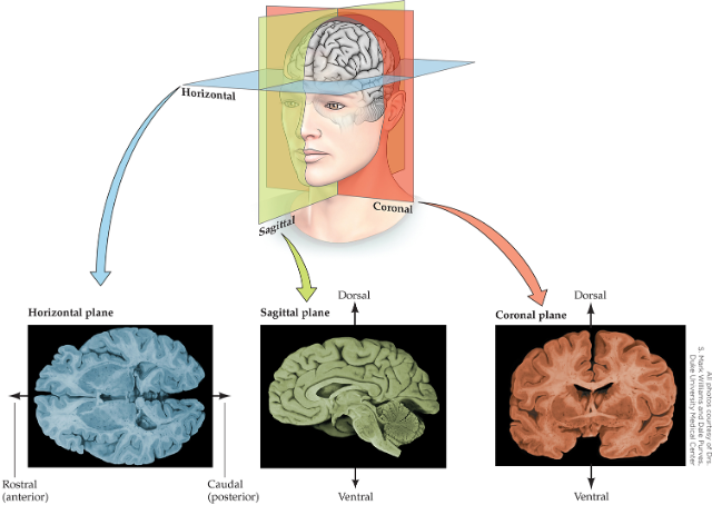 <p>Horizontal Plane, Sagittal Plane, and Coronal Plane</p>