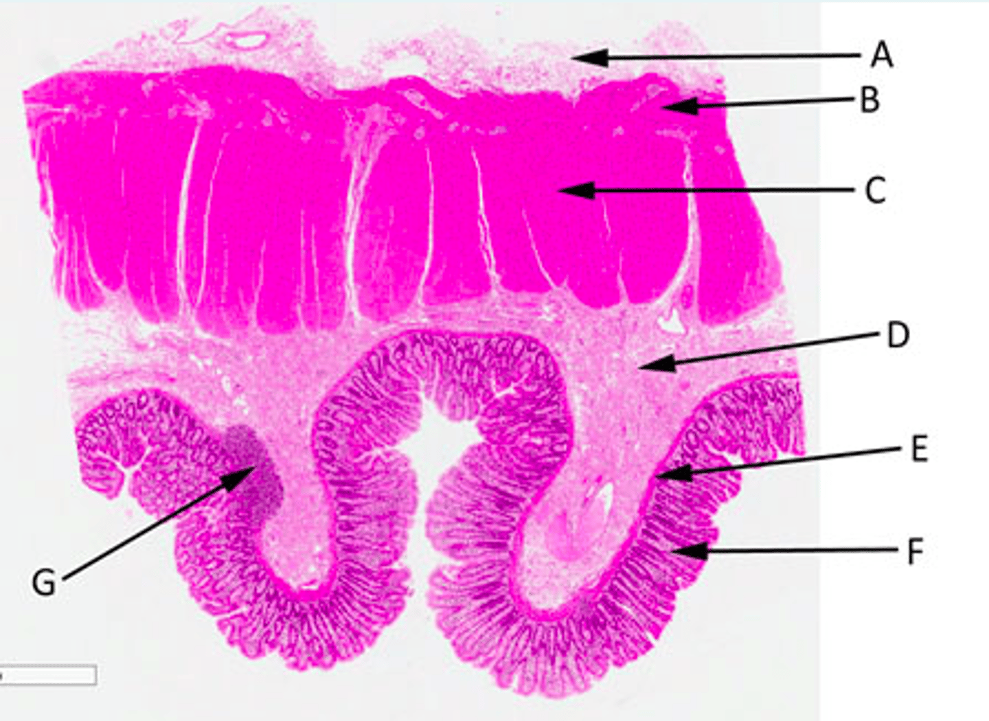 <p>A = Mesothelium comprised of connective tissue and simple squamous epithelium</p><p>B = Outer longitudinal smooth muscle</p><p>C = Inner circular smooth muscle</p><p>D = Region of loose or dense irregular connective tissue containing glands, adipose, nerve, immune cells and blood vessels </p><p>E = Structure that allows local movement of the mucosa</p><p>F = Mucous membrane comprised of simple columnar epithelium with supporting lamina propria and smooth muscle </p><p>G = Region of lymphoid tissue</p>