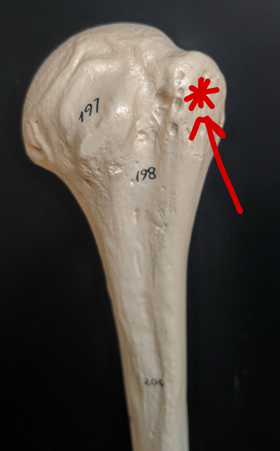 <p>Name this structure</p>