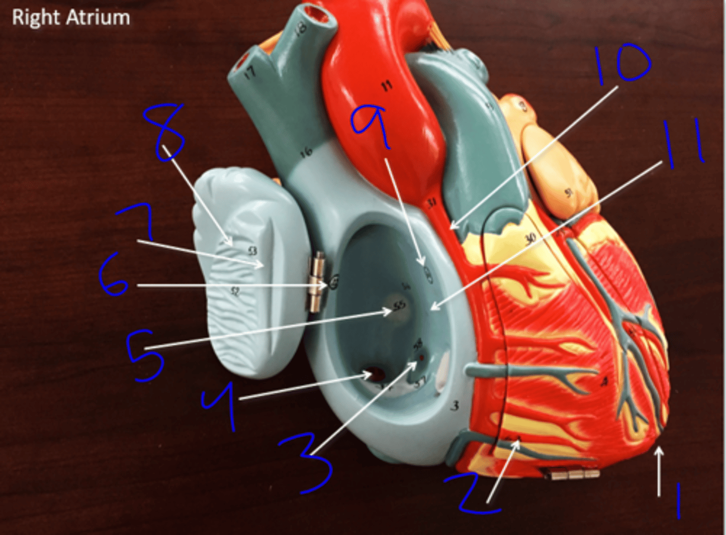 <p>Right Atrium - #4</p>