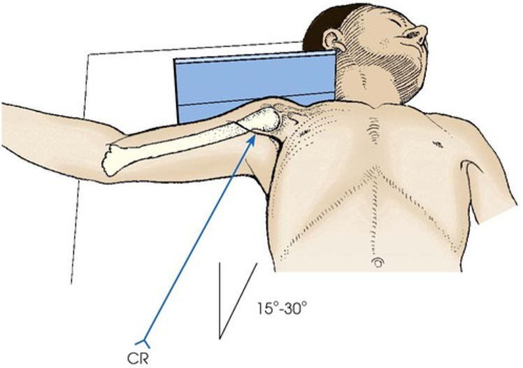 <p>Epicondyles are parallel to floor. Hand in external rotation</p>