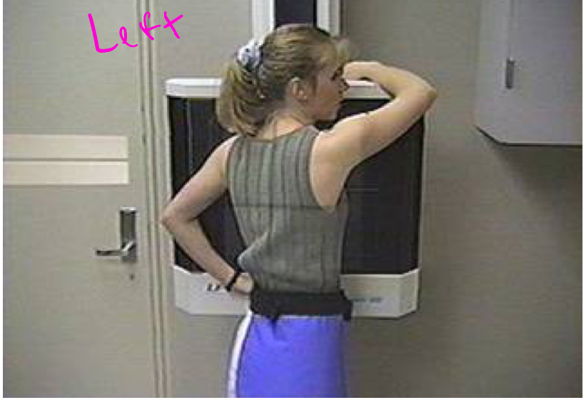 <p>Rotated view. this is left lateral oblique. Useful for shoulder joint dislocation or fractures</p>
