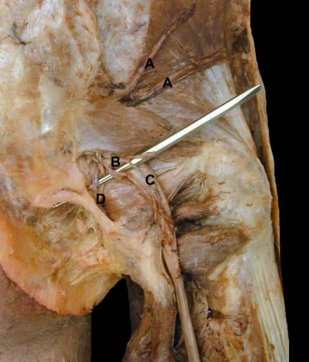 <p>A</p>