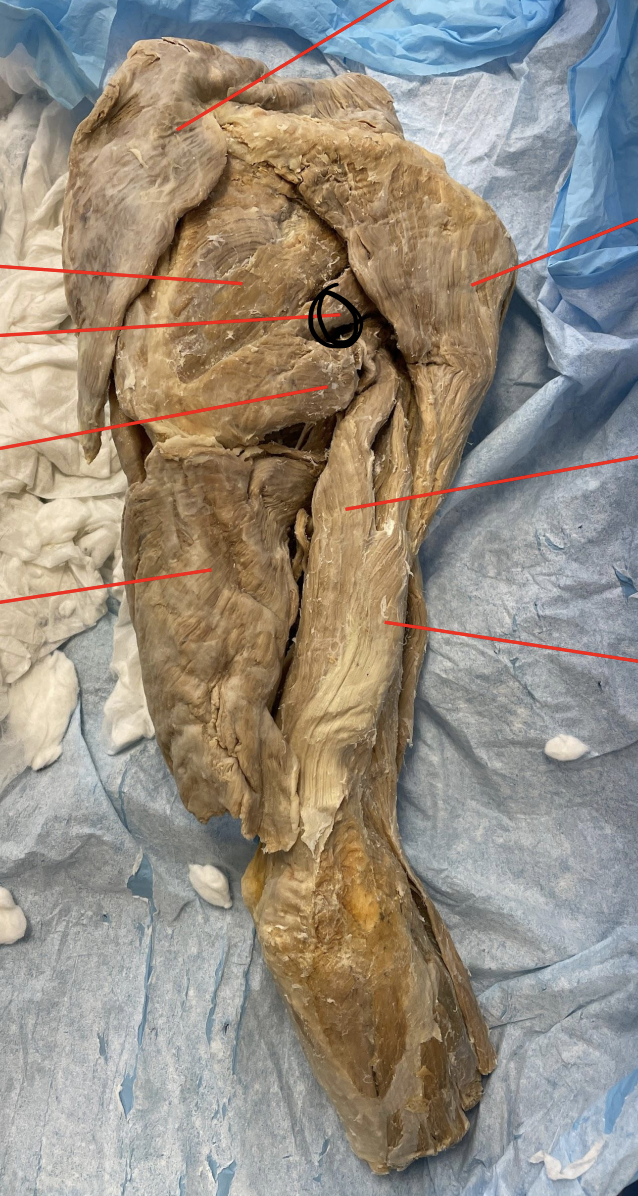 <p>identify + state origin, insertion, action, innervation of marked structure</p>