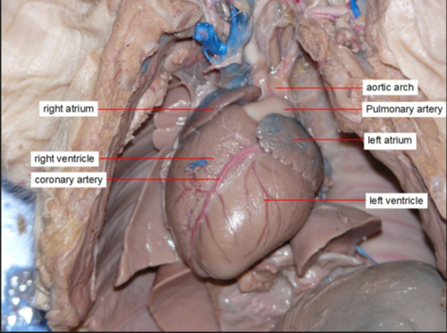 <p>Hollow, muscular organ, which functions as a pump for the movement of blood through the body.</p>