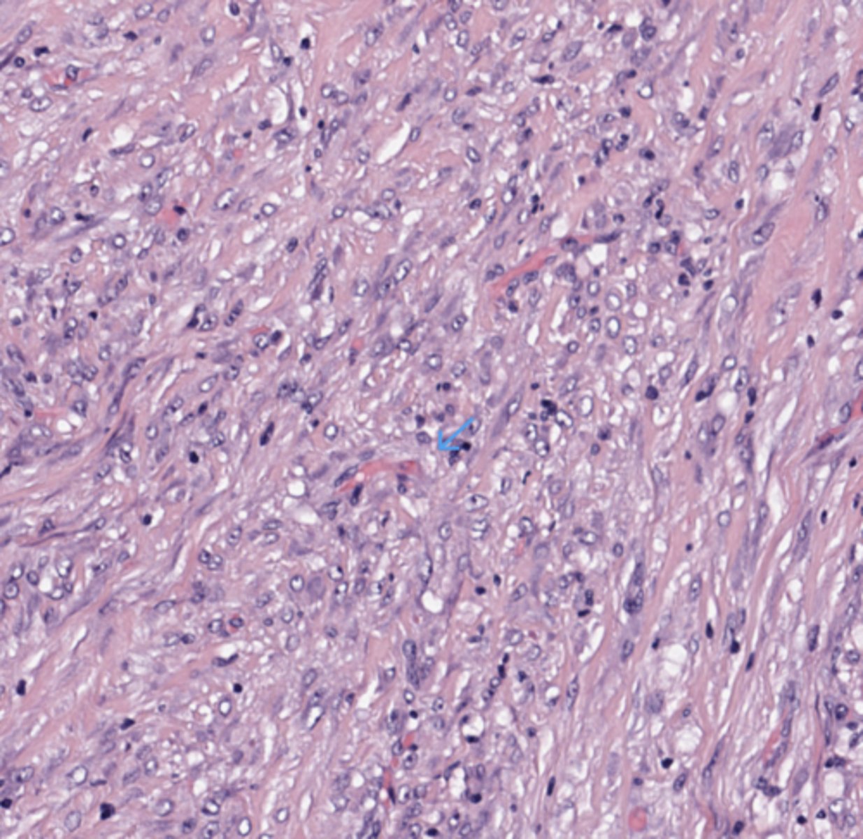 <p>Colon</p>