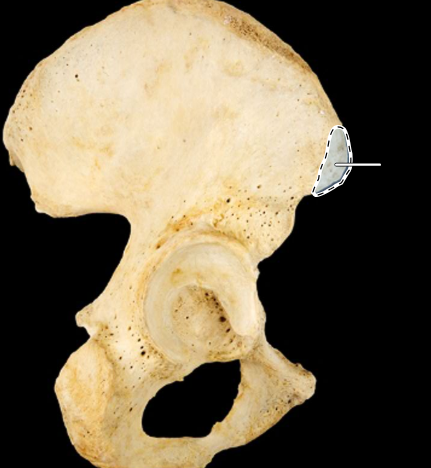 <p>Hip bone, lateral view, right ilium</p>