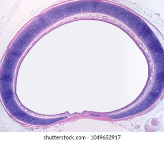 <p>What are the lungs formed and protected by?</p>