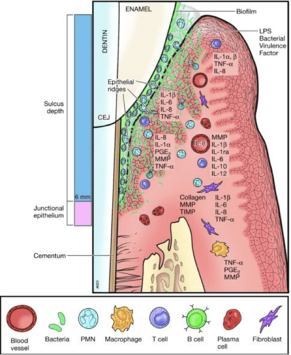 <p>tissue destruction phase ; irreversible damage to the periodontium which is the hallmark of periodontitis, Tissue destruction becomes the main outcome of the immune system response.</p><p>The immune response becomes chronic; intense inflammation begins to harm the periodontium.</p><p>Cytokines, PGE2, and MMPs destroy the connective tissue, PDL fibers &amp; bone - pocket, biofilm growing laterally and apical on root surface</p>