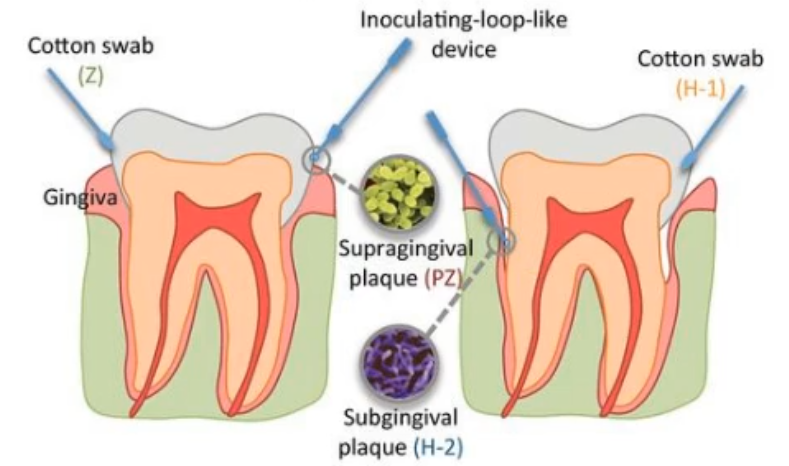 <ul><li><p>supragingival plaque</p></li><li><p>subgingival plaque-paper points</p></li><li><p>Buccal cells</p></li><li><p>tongue</p></li></ul><p>*the signatures of each of these is going to be very different from one another </p>