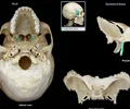 <p>sharp process that medially and inferiorly projects from the sphenoid</p>