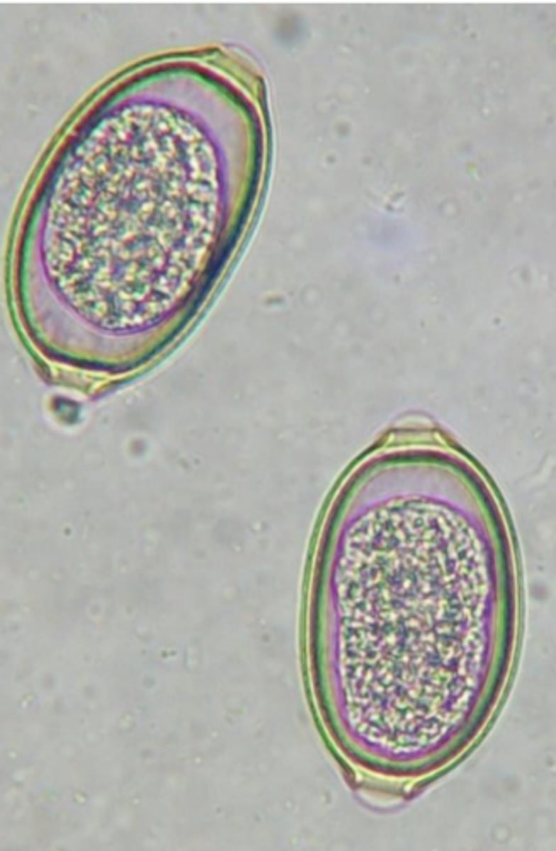 <p>Trichuris vulpis</p><p>3 multiple choice options</p>