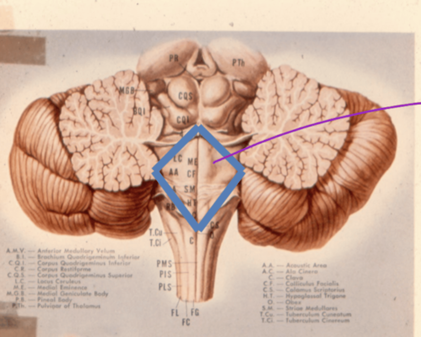 <p>floor of 4th ventricle (for the sake of our class)</p><p>dorsal aspect of tegmentum of pons</p>
