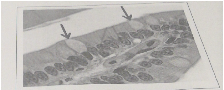 25\. The cells indicated by the arrows