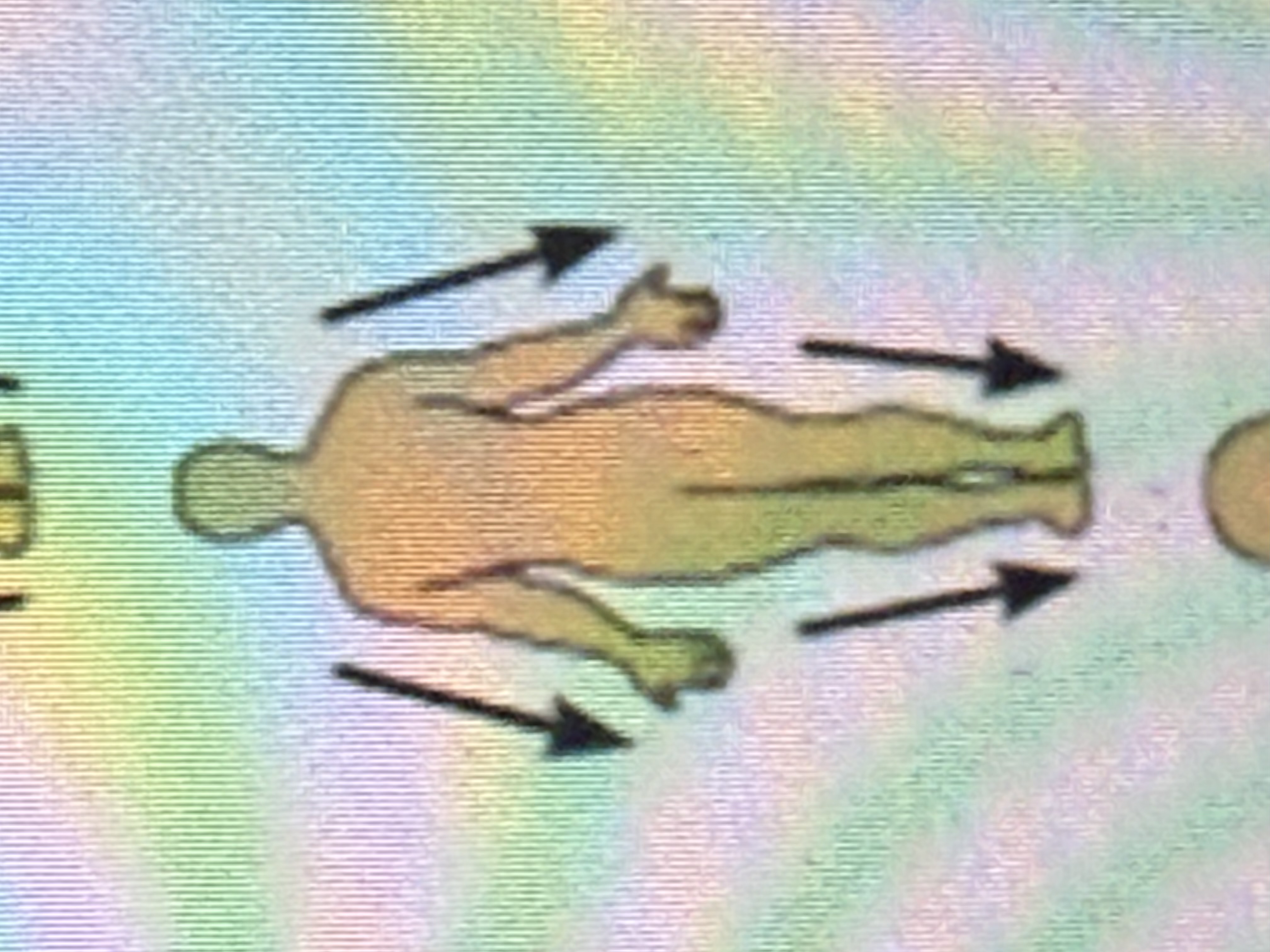 <p>Farther from the origin of a body part or the point of attachment.</p>