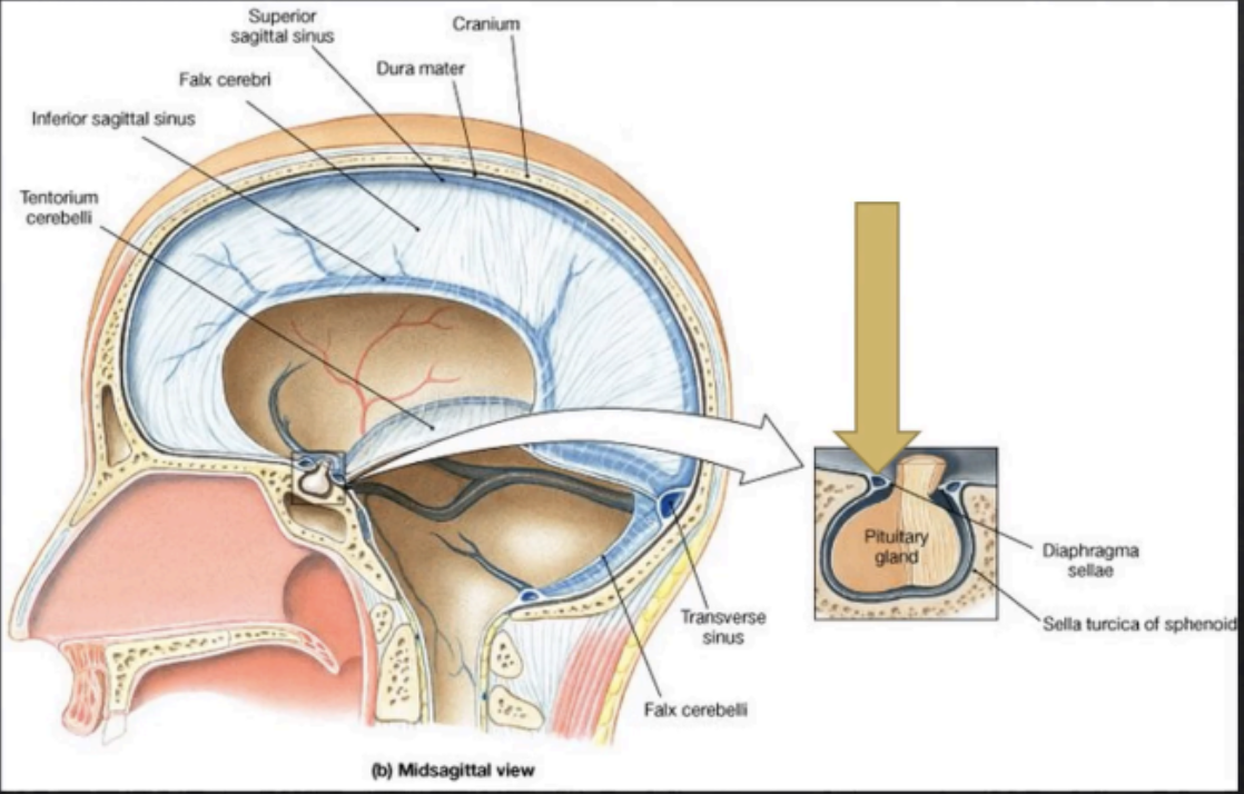 <p>Diaphragma Sellae</p>