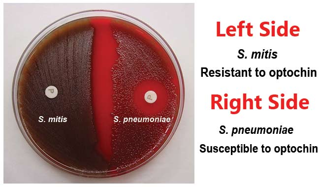 <p>c) Streptococcus pneumoniae</p><div data-type="horizontalRule"><hr></div><p><span>Opto<mark data-color="#ffffff" style="background-color: #ffffff; color: inherit">chin is </mark></span><mark data-color="#ffffff" style="background-color: #ffffff; color: inherit">a chemical compound used in microbiology to differentiate Streptococcus pneumoniae from other alpha-hemolytic streptococci</mark><span><mark data-color="#ffffff" style="background-color: #ffffff; color: inherit">.</mark></span></p>