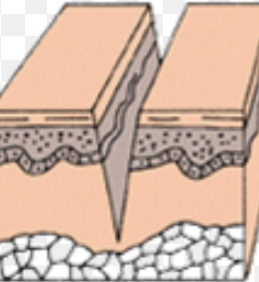 wound ends come together, leaves scar tissue; includes acute inflammation then wound closure
