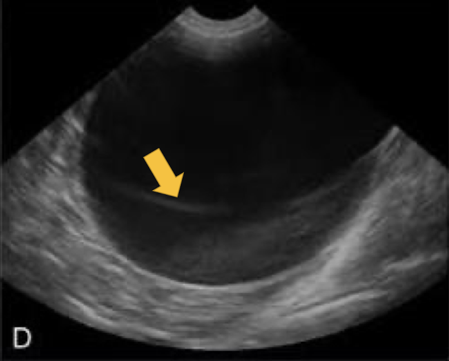 <p>What artifact is this showing?</p>