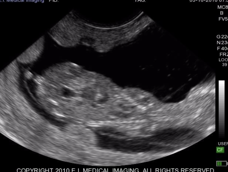 <p>at about 60 days gestation (image is of 61d - female)</p>