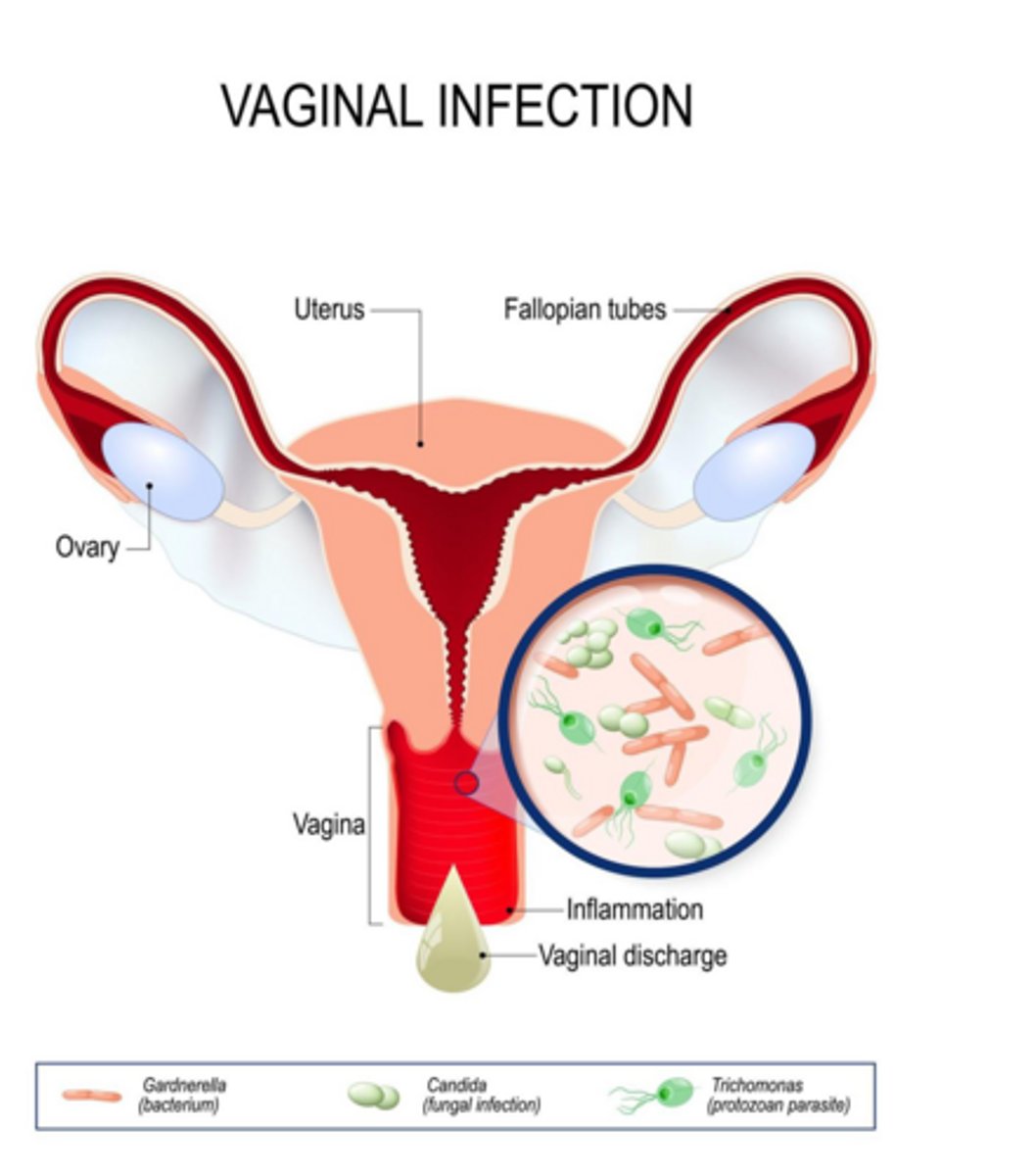 <p>Neisseria gonorrhoeae, a gram-negative diplococcus.</p>